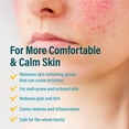 thumbnail image 2 of A+D Advanced Dermatitis Care Hydrogel Spray with Hypochlorous Acid 4 oz, 2 of 10