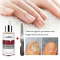 thumbnail image 2 of 12ml Nail Fungal Treatment With File Anti Fungus Onychomycosis Removal Nails Care Repair Liquid, 2 of 5