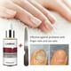 thumbnail image 2 of 12ml Nail Fungal Treatment With File Anti Fungus Onychomycosis Removal Nails Care Repair Liquid, 2 of 5
