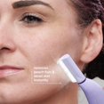 thumbnail image 4 of Sistema de dermaplanamiento Michael Todd Beauty Sonicsmooth Pro+, 4 of 8