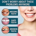 thumbnail image 2 of Adjustable Snap On Prothesens, Adjustable Snap On Denture, Silicone Whitening Denture Braces, Cover The Imperfect Teeth, 2 of 5