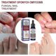 thumbnail image 2 of Nail Treatment Nail Care Manicure And Pedicure Nourishing And Cleansing Removal Of Grey Nails 50ml Box, 2 of 4