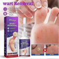 thumbnail image 3 of 2pcs Corn Removal Extra Strengthen Gel Foot Callus Removal Treatment Hard Skin, 3 of 5