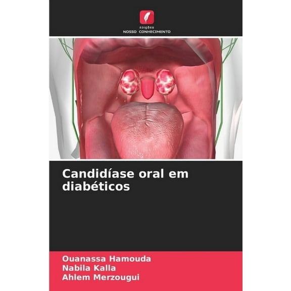 CandidÃ­ase oral em diabÃ©ticos, (Paperback)