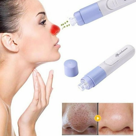 Portable Electric Skin Facial Pore Spot Suction Remover Blackhead Vacuum Acne (Best Over The Counter Facial Spot Remover)