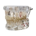 thumbnail image 1 of lionlar Dental Demonstration Teeth Model Observation Practical Removable Study Teach transparent, 1 of 9