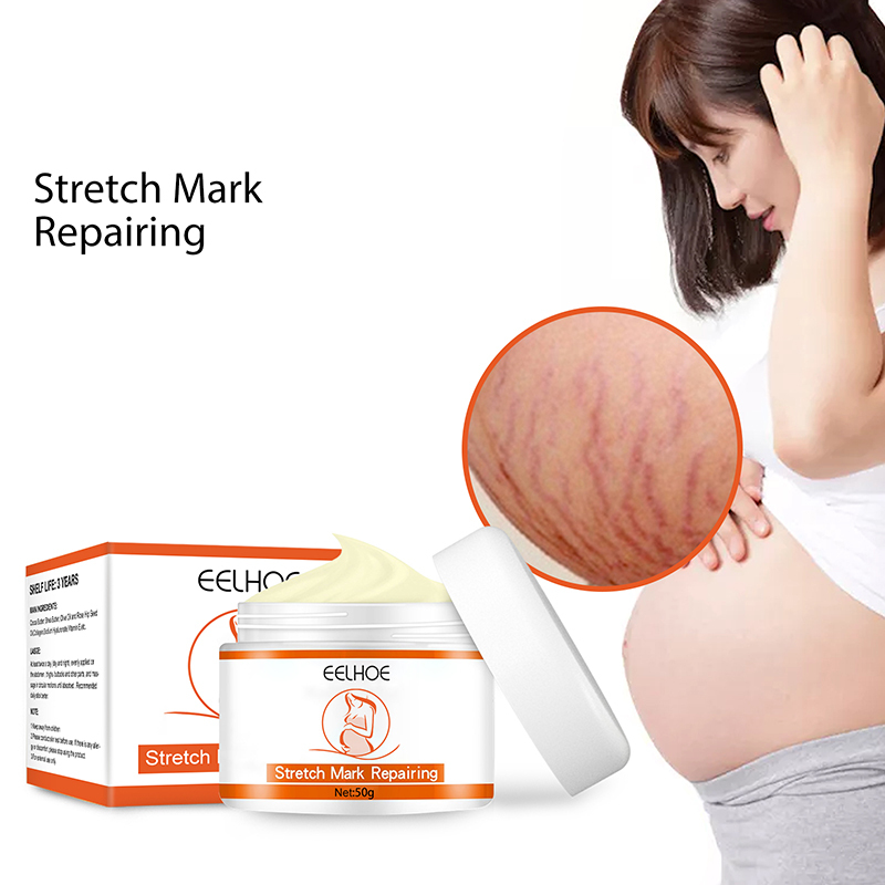 Stretch Marks Remover Essential Oil Stretch Marks Treatment Maternity Repair Remove Pregnancy