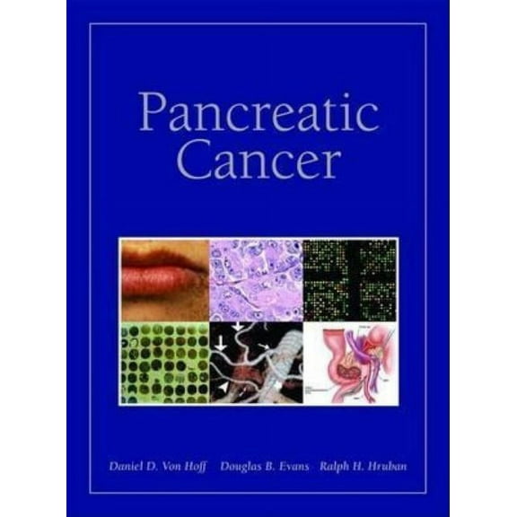Pancreatic Cancer (Hardcover)