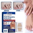 thumbnail image 3 of 60pcs Toenail Fungus Treatment Stickers Ingrowning Toenail Nail Repair Patch, 3 of 5