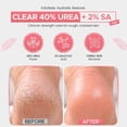 thumbnail image 2 of CLEAR 40 Urea Cream 40 Percent for Feet Maximum Strength (8oz) | Softens Cracked Heels & Dry Skin Urea Cream 40 Percent - Tea Tree & Coconut Oil | Urea Cream for Callus & Corn Treatment | Made in USA, 2 of 7