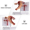 thumbnail image 2 of Pathological Uterus Ovary Model, Female Reproductive Organ Model Human Uterus Anatomical Model with Educational Display Card and Base, for Teaching Learning, 2 of 8