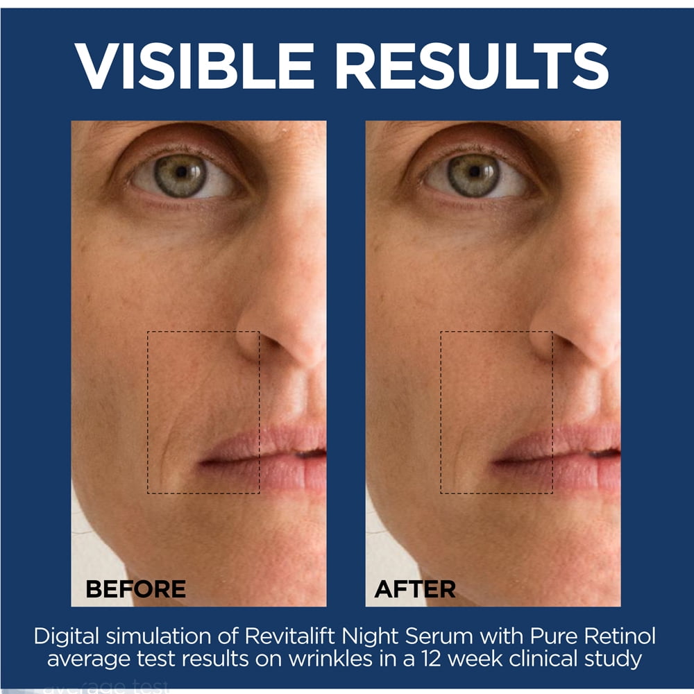 retinol serum 0.3