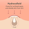 thumbnail image 4 of Rael Miracle Invisible Spot Cover - Hydrocolloid, Absorbing Cover, Skin Care, Facial Stickers, 2 Sizes (24 Count), 4 of 8