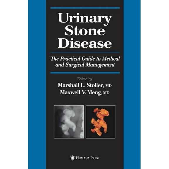 Current Clinical Urology Urinary Stone Disease: The Practical Guide to Medical and Surgical Management, (Hardcover)