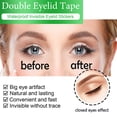 thumbnail image 1 of Cinta De Doble Párpado 396PCS Big Eye Tools Tiras de levantamiento de párpados de 3 formas para tapas caídas para ojos con capucha Wdftyju  Cuidado Belleza, 1 of 5