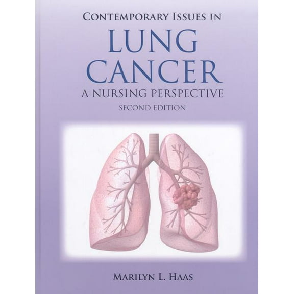 Contemporary Issues in Lung Cancer: ., (Paperback)