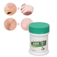 thumbnail image 3 of Crema Para Herpes Zóster, Crema Multifuncional Para El Tratamiento De La Varicela, Alivia La Picazón Para La Subsalud De Los Ancianos, 3 of 7
