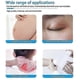 thumbnail image 4 of Losveo Silicone Scar Sheets For Face Wrinkles,Medical Grade Silicone Scar Sheets,Reusable Silicone Scar Strips for Scar Treatment, 4 of 5