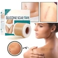 thumbnail image 5 of Silicone Scar Sheets, Silicone Scar Tape(1.6” x 120” Roll-3M), Scar Removal Away Strips for Surgical Scars, Keloid, C-Section, Burn et, 5 of 6