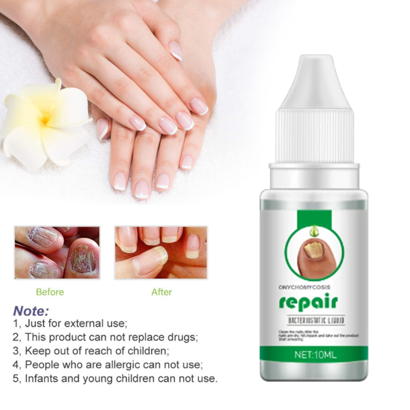 Eelhoe Onychomycosis Repair Liquid Nail Treatment Liquid Thicken Soft