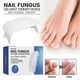 thumbnail image 2 of 1-2PCS LED Nail Fungus Laser Treatment Device for Damaged ToenailsOnychomycosis Buster, 2 of 5