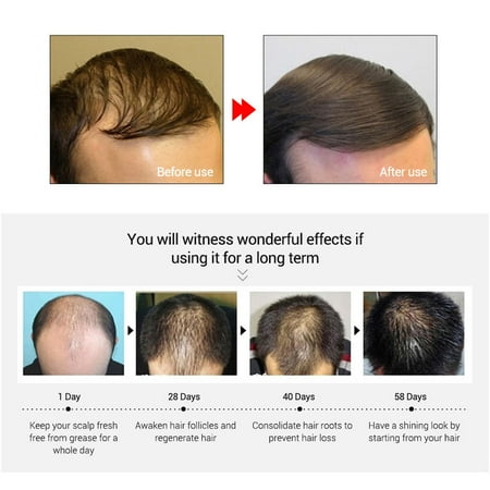 Hair Pomade Scalp And Root Earths Enrichments Hair Care