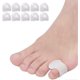 thumbnail image 1 of Gel Toe Separators,10 Pack Pinky Toe Spacers For Overlapping Toes, Bunions, Big Toe Alignment,hammer Toe Straighteners New Arrival, 1 of 5