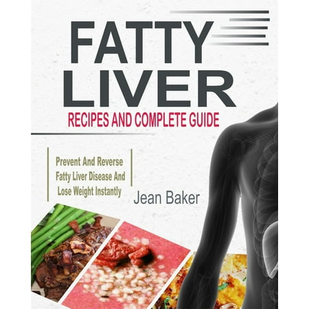 Fatty Liver: Recipes And Complete Guide To Prevent And Reverse Fatty Liver Disease And Lose Weight Instantly - (Best Foods For Fatty Liver Disease)