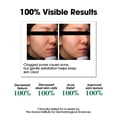thumbnail image 4 of Tónico facial SOME BY MI AHA BHA PHA 30 Days Miracle 150 ml, 4 of 8