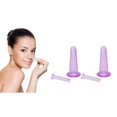 thumbnail image 1 of Koppning - vakuumkoppar set 4pack, 1 of 1