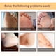 thumbnail image 5 of Paquete de 3 exfoliantes para pies, agente exfoliante natural, utilizado para piel seca, callos, reparación de talones ásperos, suaviza los pies y consigue una piel suave, 5 of 5