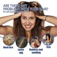 thumbnail image 4 of 1-3pcs Lice Removal Spray For Head Lice Removal Head Lice Removal Spray Scabies Lice, 4 of 5