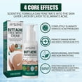 thumbnail image 3 of Crema hidratante para el cuidado de la cadera Jaysuing que atenúa las marcas de viruela, refresca y rejuvenece la piel, crema hidratante suave reparadora antiacné | | 100 ml |, 3 of 5