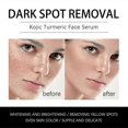 thumbnail image 2 of 1pc Jaysuing Anti-dark Spot Facial Essence Fades Spots And Spots Brightens Skin Tone To Remove Melanin Moisturizing Essence |, 2 of 5