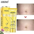 thumbnail image 1 of Crema para eliminar las estrías de rosa, crema para la obesidad posparto, reparación de mujeres embarazadas, arrugas antienvejecimiento, elimina las cicatrices del embarazo, crema corporal kaili Sencillez, 1 of 5