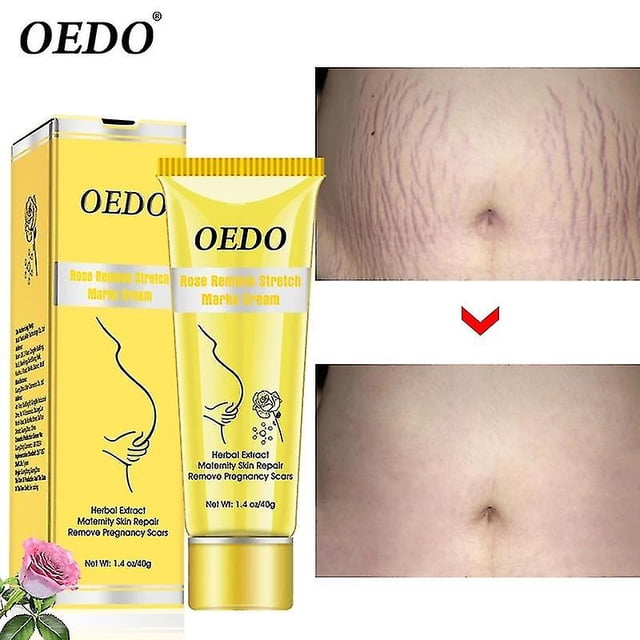Crema para eliminar las estrías de rosa, crema para la obesidad posparto, reparación de mujeres embarazadas, arrugas antienvejecimiento, elimina las cicatrices del embarazo, crema corporal kaili Sencillez