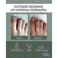 thumbnail image 4 of 5x Healthroutine Nail Care Pen Cosmetic Nail Fungus Treatment Quick Intensive For Nails With Aloe Vera Tea Tree Oil_y62, 4 of 5