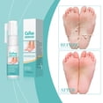 thumbnail image 3 of ONLYEOR Foot Peeling Spray, Foot Exfoliating Spray, Moisturizing & Smooth Feet Skin, Gently Exfoliates Away Rough, Dry Skin 20ml, 3 of 7