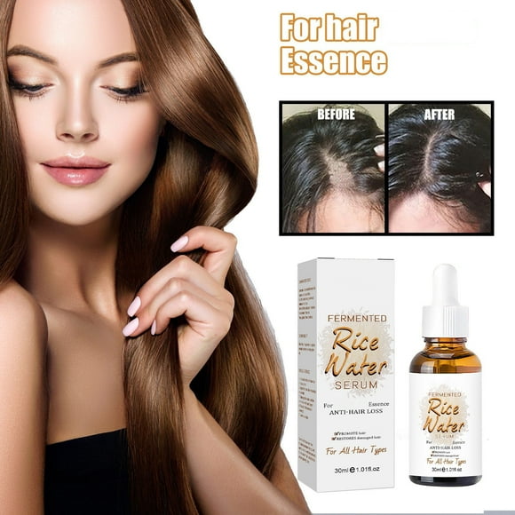 Fiudx Acete Agua de Arroz, Loción Capilar de Consistencia Espesa, Suero Reparador y Suavizante para Cuero Cabelludo, Solución para Cabello Seco Que Controla El Frizz, Uso Diario, Apto Tipo de Cabello