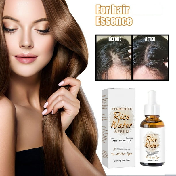 Fiudx Acete Agua de Arroz, Loción Capilar de Consistencia Espesa, Suero Reparador y Suavizante para Cuero Cabelludo, Solución para Cabello Seco Que Controla El Frizz, Uso Diario, Apto Tipo de Cabello