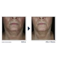 thumbnail image 3 of Crema para el cuello RoC Derm Correxion con ácido hialurónico y retinol 50 ml, 3 of 7
