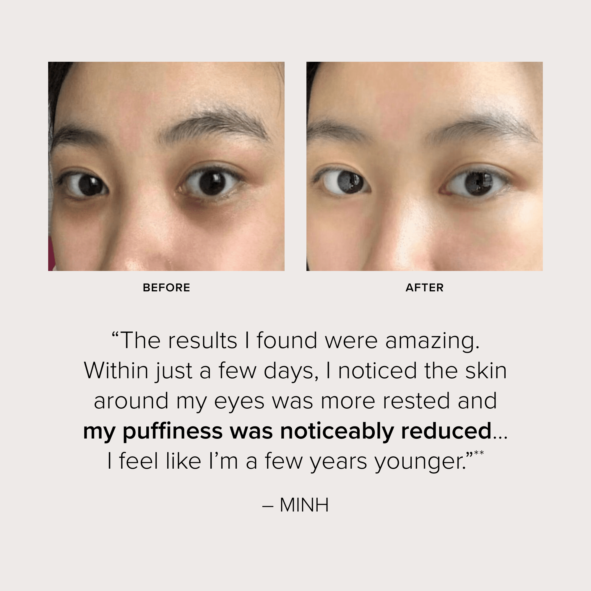 SeroVital Dark Circle Eraser - Hormone Aware Skincare - Visibly Tone, Smooth,  Boost Brightness Around the Eyes