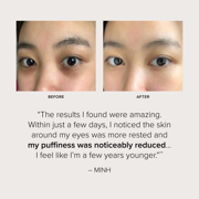 SeroVital Dark Circle Eraser - Hormone Aware Skincare - Visibly Tone, Smooth, Boost Brightness Around the Eyes