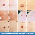 thumbnail image 5 of IBeaLee Vitamin C Facial essence Lighten fine lines and remove acne prints, brighten skin tone, moisturize and tighten skin essence, 5 of 5