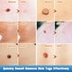 thumbnail image 5 of IBeaLee Cross border Wart Removal Liquid, Youfu Flat Liquid, Huangzi Point Mole Liquid, Chicken Eye Filament Flat Youde Removal Liquid, 5 of 5