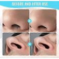 thumbnail image 1 of 2-in-1 Nasal Hair Cutter Double Sided Nose Hair Knife Nostril Hair Remover Tool, 1 of 2