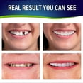 thumbnail image 3 of 2022new 2 Sets Of Dentures, Upper And Lower Jaw Dentures, And Comfortable, Protect The Teeth, And Regain, 3 of 3