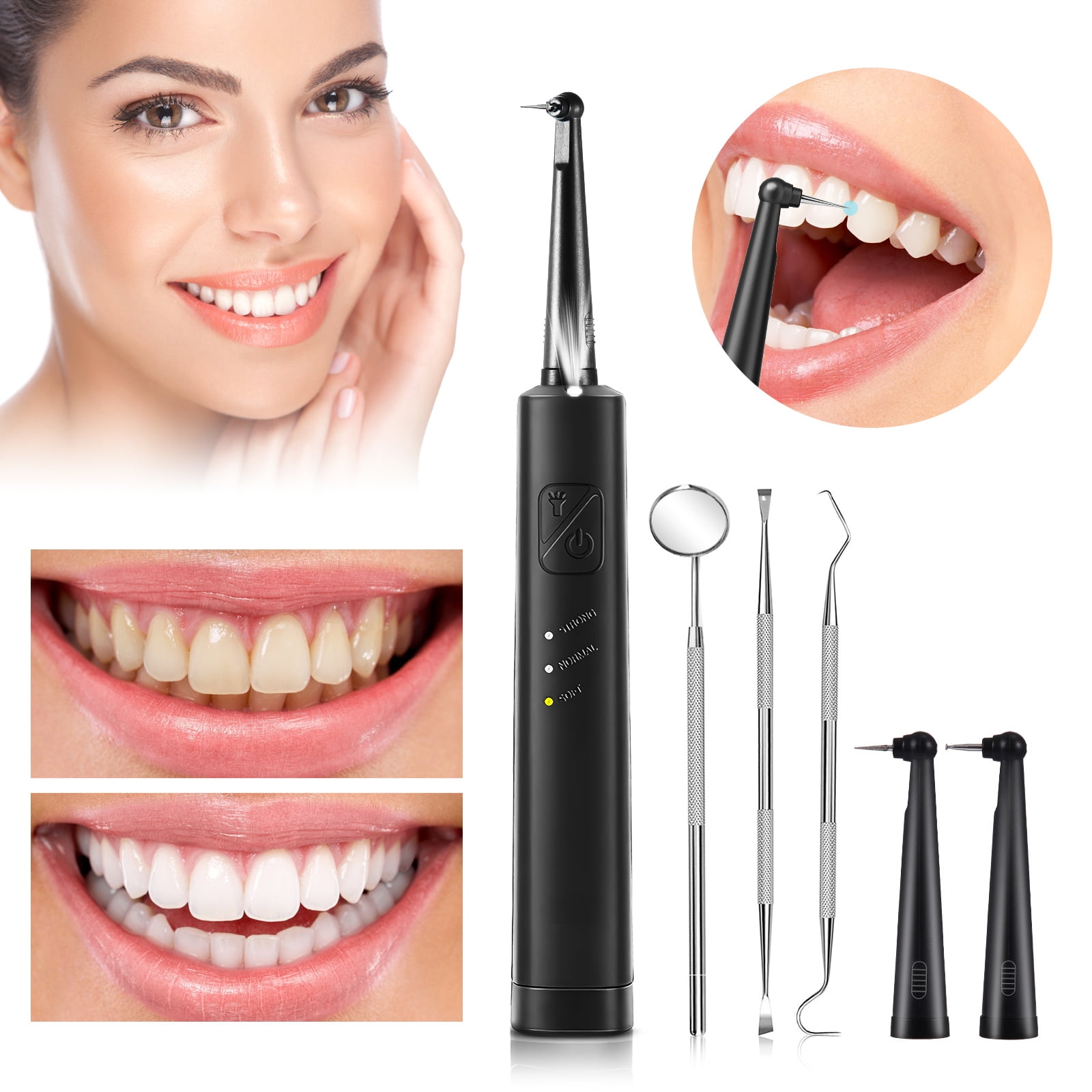 Electric Dental Calculus Remover for Teeth,Effectively Removes Calculus