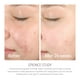 thumbnail image 3 of Gel limpiador Epionce Lytic 100 ml para pieles grasas y con problemas, 3 of 9