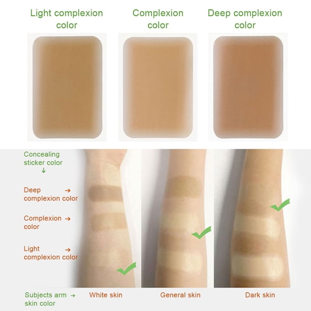 Cubierta de cicatrices, Scar Cover, Hojas de silicona para cicatrices para cubierta impermeable de cicatrices, cinta adhesiva para tatuaje, cinta para cubrir cicatrices, tratamiento de cicatrices(4 #) Ecomeon no